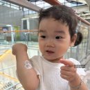 강원대학교병원 | 몽고반점 레이저치료일기 ep.5 - 7~8회차 레이저 치료 그리고 전원...(강원대학교병원,아름다운피부과의원)