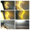 덴트렉스 이미지