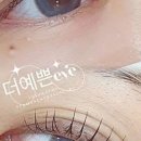 예쁜EYE 이미지