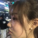 재건 | 대전여드름관리 라온하제 에스테틱 피부 재건관리 후기