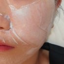모비디크 | 이대피부관리 모비디크 윤곽관리 추천! 예민피부도 가능한 1:1 스킨부스터 후기