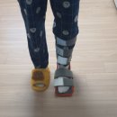 꽁쭈발관리 앞 횡단보도 | 발목인대 파열되셨어요? 회복 치료 관리 후기