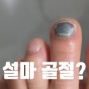 장위성모정형외과의원 | 안산 정형외과 추천｜발가락 부상으로 방문한 성모본정형외과 후기