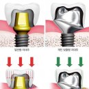 이룸치과기공소 이미지
