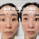 내돈내산 성북 솔샘 피부케어 관리 만족! 재방문!! 레디언스필 후기 [여우미스킨케어]