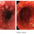 참조은내과 네이버블로그