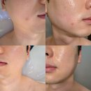 해운대 피부관리 얼굴 작아보이는 4D입체윤곽 후기 더함에스테틱 해운대본점