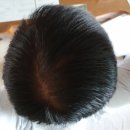 알라딘의료기 이미지