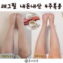필약국 | 레그필 내돈내산 4주 복용효과 솔직후기 종아리부종 영양제 (비교사진)