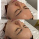 매영로310번길 | [수원/영통] 영통피부관리 올가드림뷰티 PDRN 물광관리 후기