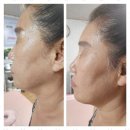 예쁘제 | 기장마사지 새로운 나를 만나는 곳, 예쁘제스킨샵 후기