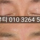 고은하늘성형외과의원 네이버블로그