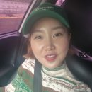 보조개시술 1개월차 부작용과 수술후기