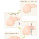 라파엘외과의원 네이버블로그