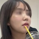 코편한한의원 | 구월동 하이코리프팅 후기｜코 라인 정리 위해 받아본 하이코 시술 후기