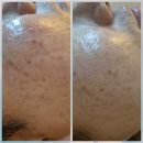 황후에스테틱 | 안산 중앙동 피부관리 맛집 황후 에스테틱에서 수분 미백관리한 후기