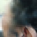 독일렉스톤보청기 의정부점 이미지