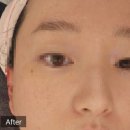 6866 | 상주피부클리닉 잘하는 곳 "에스테틱 소휴" 방문 후기