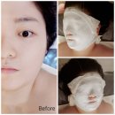 여가뷰티 | 내 얼굴이 달라지는 광주 윤곽관리 풍암동 포미뷰티 솔직후기