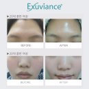 비아스킨