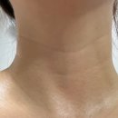 거꾸로 나이 드는 습관 | 광노화 줄이는 생활습관 피부 노화 걱정되어 추가한 관리 방법