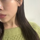 비너스 달걀주사 방배 조각주사 이중턱 브이라인 효과 본 방배피부과 내돈내산 후기