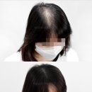 리게인프로젝트 강남본점 이미지