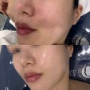 더고은피부 | 다산역 피부관리, &#34;더고은피부전문센터&#34; 임산부 재생관리 후기