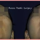 로코코성형외과의원 이미지