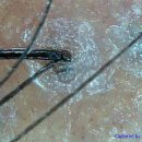 지성헤어크리닉 이미지