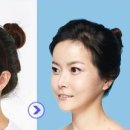 AJ성형외과 네이버블로그