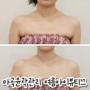 마곡윤곽관리 예신관리 여름아이뷰티끄 후기