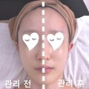 뉴로밸런스 | 인천 논현동 피부관리 눈부신미모 뉴로에이징리벨런스 신부관리 후기