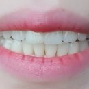 투스노스 이미지