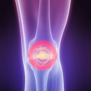 서울제일보조기 이미지