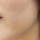 (주)부경알엔에스 | 라운딩 후 피부 진정시키기 알엔에스 리포실크 바이오...피부관리샵에서도 못구한 내피부 복구한 후기)