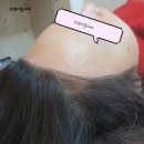 수경헤어라인 네이버블로그