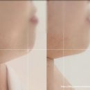 더 예쁨 | 포항 웨딩 피부관리 더예쁨 에스테틱 이중턱관리후기