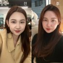뉴라인 | 부산 서면 뉴라인성형외과 VT주사 (윤곽주사 턱보톡스) 콧볼보톡스 시술 후기