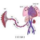 선천성 심장질환 (Congenital heart disease) 이미지