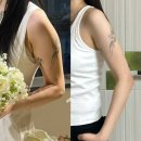 팔뚝 람스 지방분해주사 한달 후기 팔 둘레 2cm 줄었어요