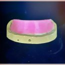 선사치과기공소 이미지