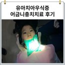유아 치아우식증 6세 유아충치 어금니충치치료 은니 비용 후기