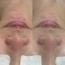 회복의 봄 페이스 앤 바디 | 여름철 피부관리법 제대로 알고 계신가요? 회복의봄페이스앤바디 청라점에서 해결하세요