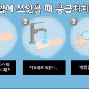 6월 4주 - ＜생활안전＞ 동물에게 물렸어요 이미지