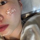 스트레스 타파 난타 | [창원 중동] 피부를 가꾸다 원데이필 2탄 : 각질 탈락 과정부터 깐달걀 완성까지! 🥚✨