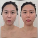 기장미소뷰티 | 정관비대칭관리 에스테틱 썬플 후기 및 주차