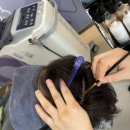 두피 탈모 아미치 0.3 수원점 이미지