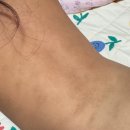 청구중학교 | 덱세릴 MD크림 (실손보험가능) 대용량구매