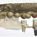 가산디지털치과기공소 이미지